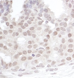 Gemin 4 Antibody, Novus Biologicals 0.1mL; Unlabeled:Antibodies, Polyclonal